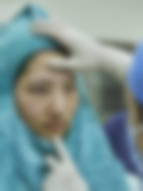 未成年想割双眼皮，除了陪同签字还要准备这些资料