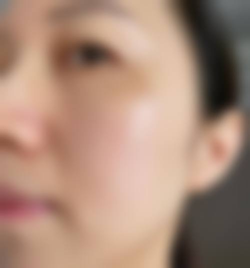 四、吴惠青医生技术优势与操作流程