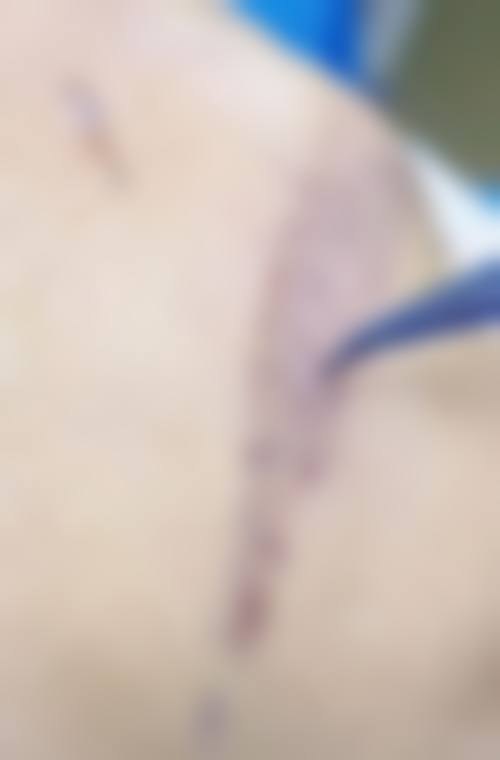 五、宁波摩范植发专科诊所价格表区间/收费标准说明