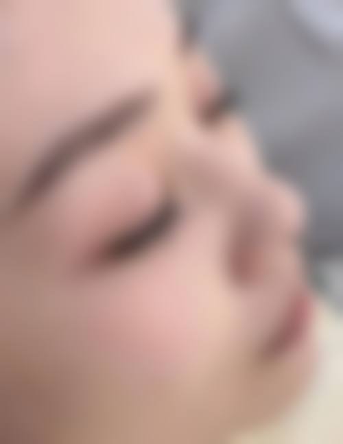 八、患者常见问题解答（精选 ）