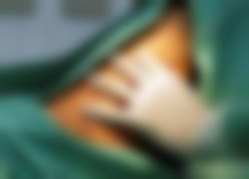 十、相关科普内容推荐——馒化脸修复