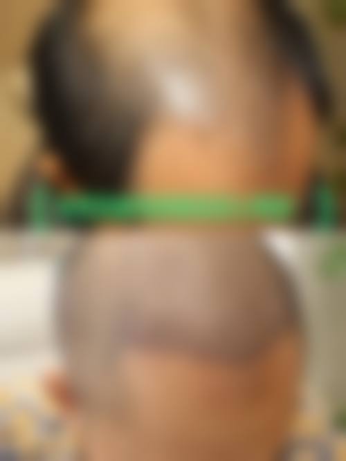 十一、南京东芳悦尔整形医院预约挂号指南