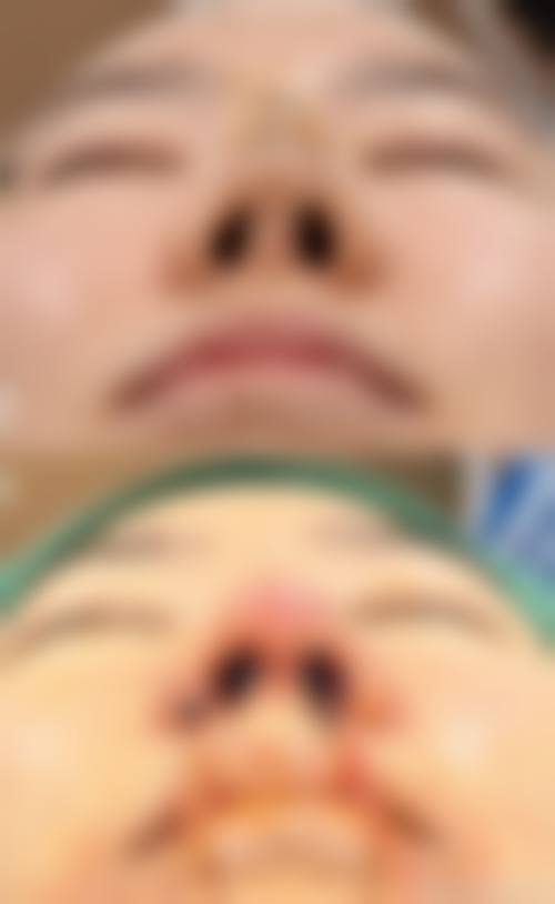 十、选择鼻子线提升隆鼻相关医院与医生时，应重点看哪些维度？