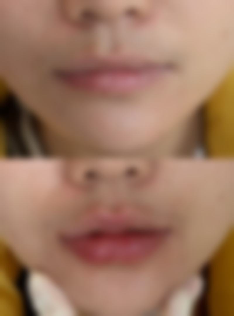 李东良医生收费价格