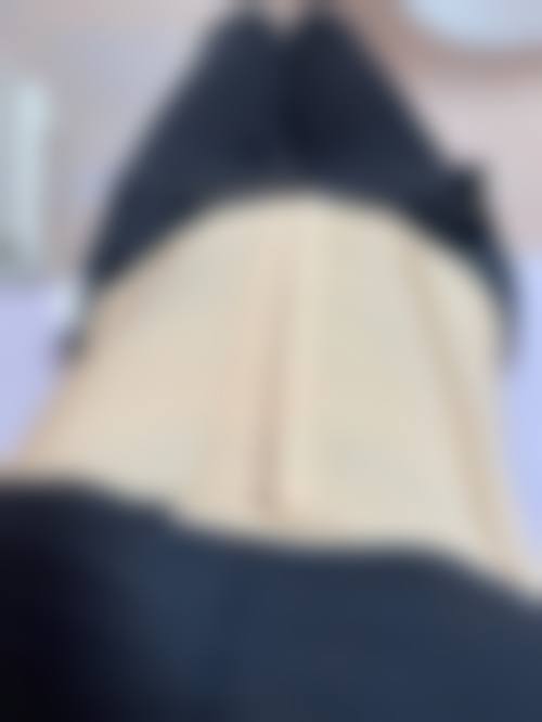 1、主要做的三大诊疗项目