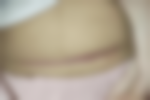 四、广州妃整形医院特色诊疗项目