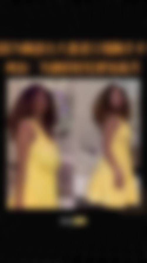 西安国际医学中心整形费用贵吗?