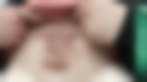 疤痕疙瘩激光治疗后会复发吗