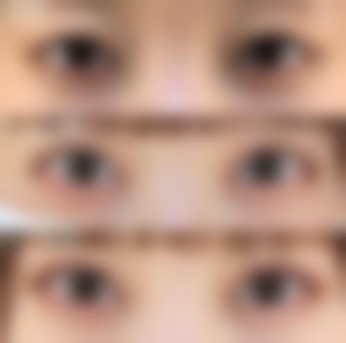 郑州医学校附属美容整形医院是正规医院吗？