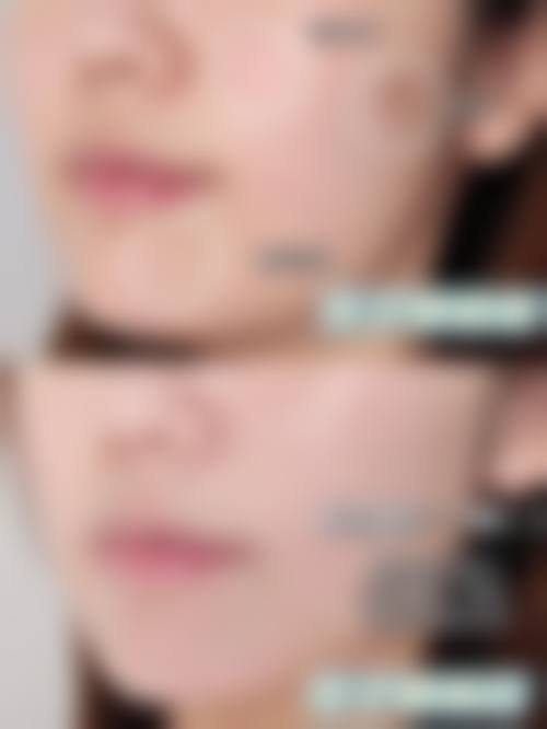 八、黄秀丽医生预约挂号指南