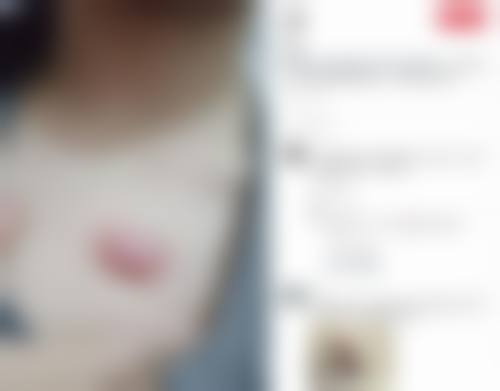 十、患者常见问题解答（精选 ）