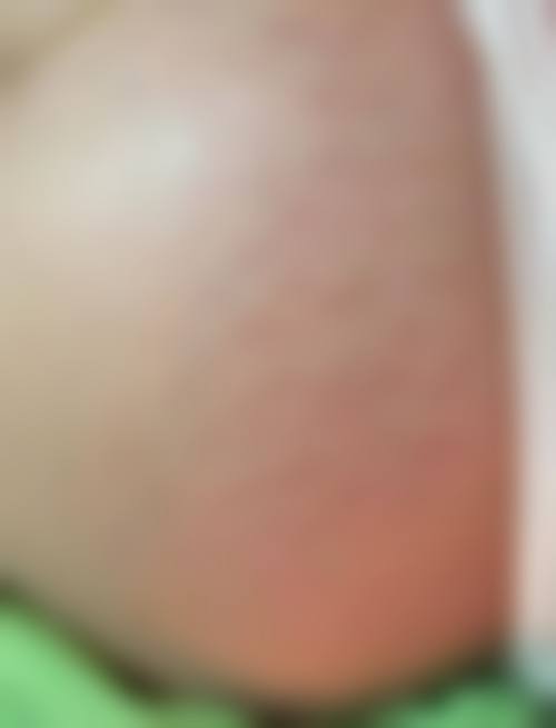 ★王牌专科诊疗项目全解析