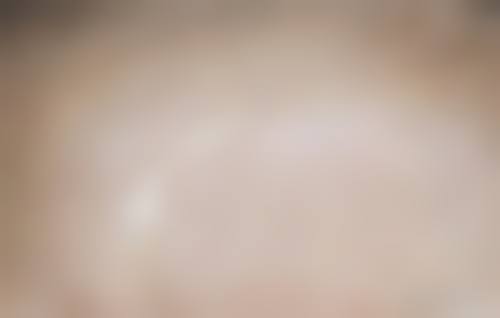 6、昆明璀璨人生整形医院口碑好评反馈