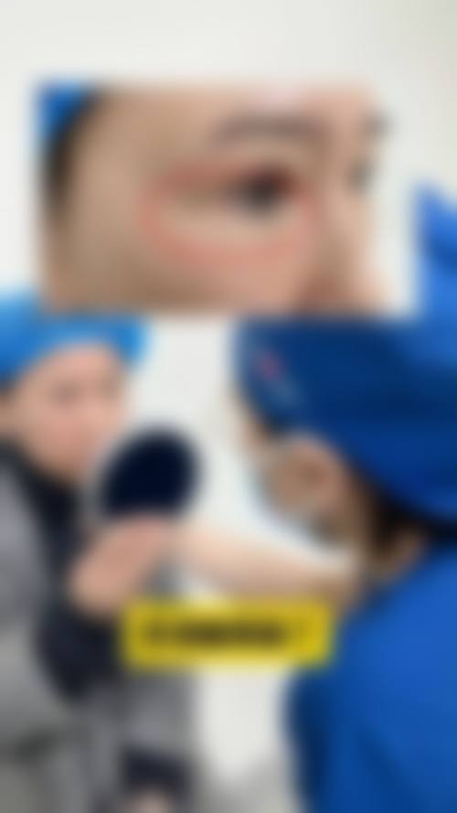 {不用手术去眼袋是真的吗？当然！激光/射频/中医调理3大方法+1000-7000元方案，轻松告别眼袋困扰！