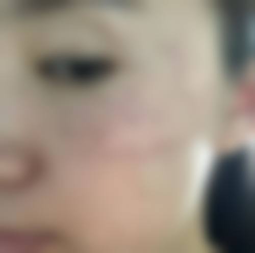 三、徐高淳医生擅长项目与适合人群