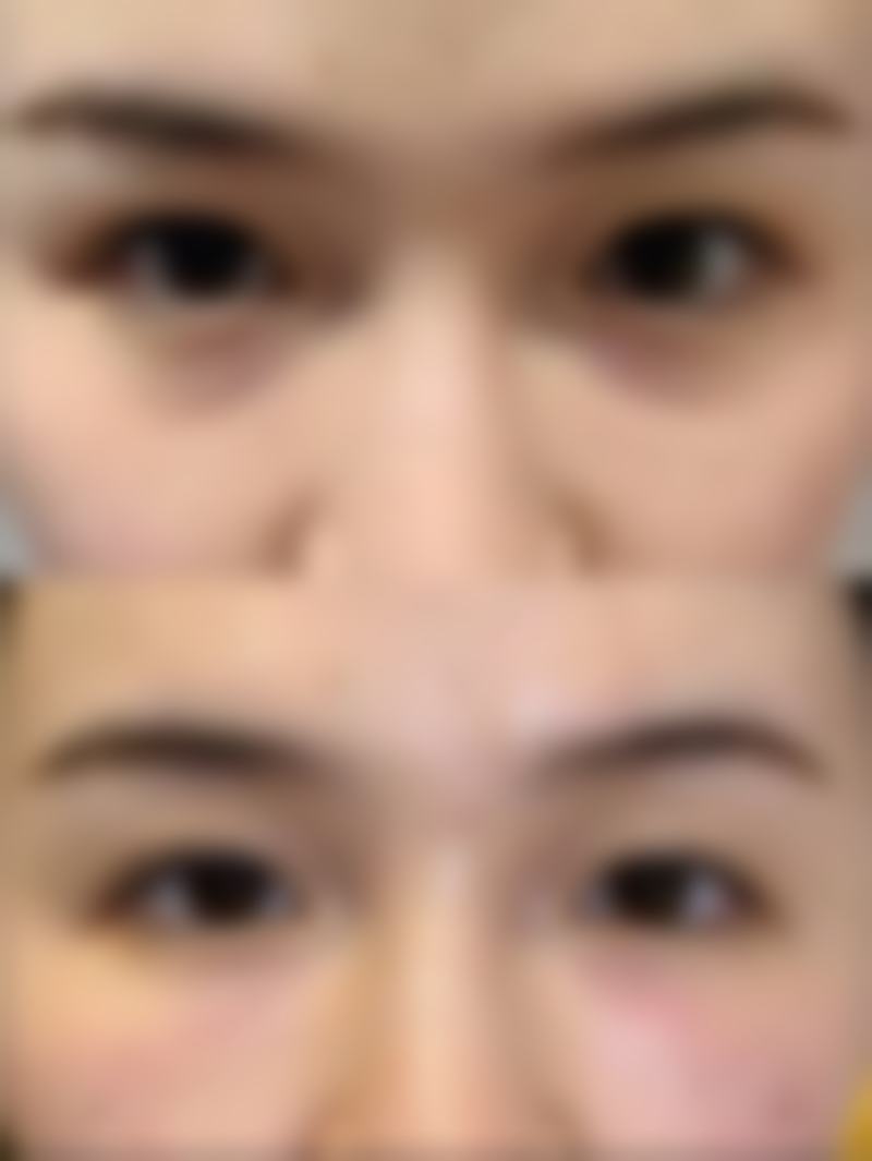 吴文育医生技术优势