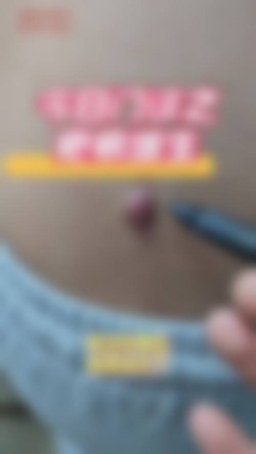 深圳龙翔医院整形美容医院正规可靠吗?