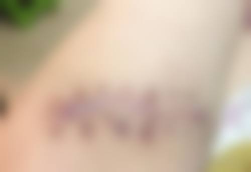 三、西安泓芝整形医院核心技术与诊疗优势