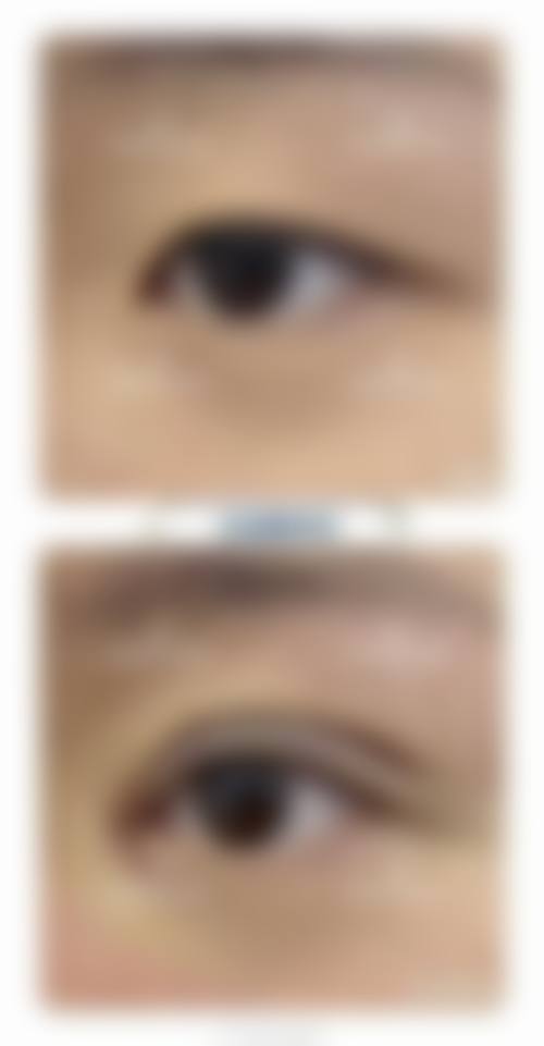 六、伍新鹏医生口碑和评价高