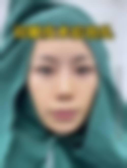 七、伍新鹏医生整形项目价格表/收费标准一览（2026年全新）