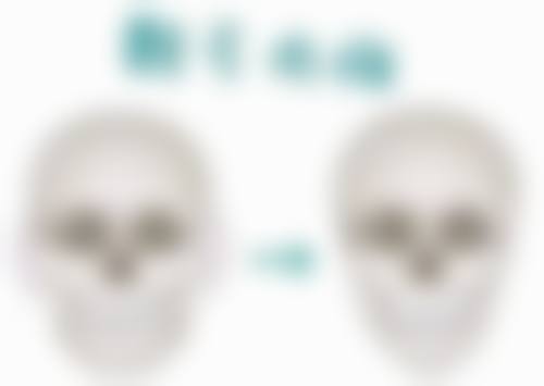 2、女性生殖器整形核心技术优势