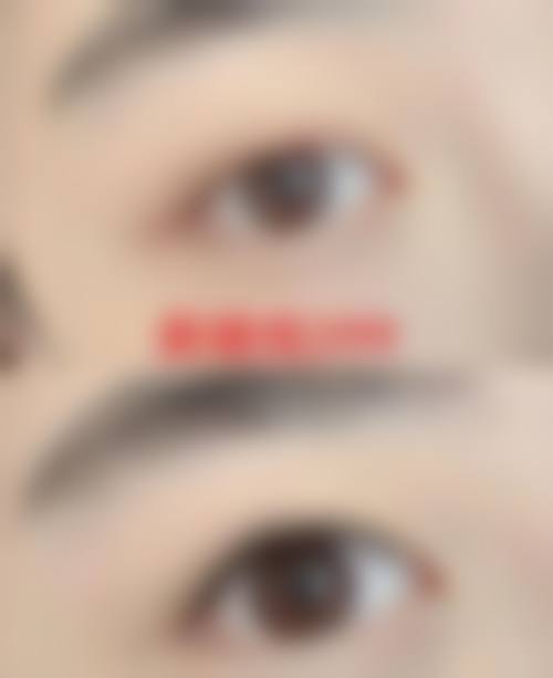 四、黄慧玲医生技术优势与操作流程