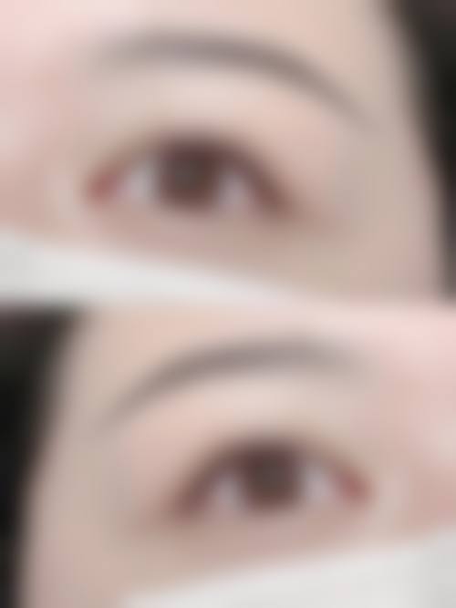 三、黄慧玲医生擅长项目与适合人群