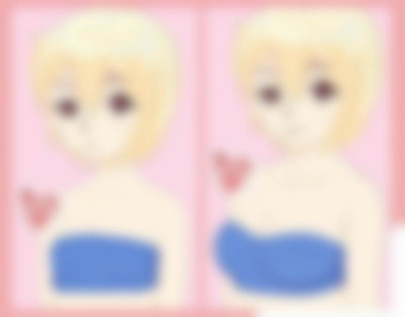 欧阳春医生技术为何能成模板？三大核心技术突破，解决全肋隆鼻难题