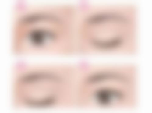 济南伊美医疗整形美容医院口碑如何？来看患者真实评价