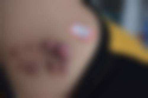 七、患者常见问题解答（精选 ）