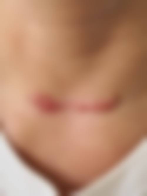 四、西安德莱美医疗美容医院收费价格表/收费标准