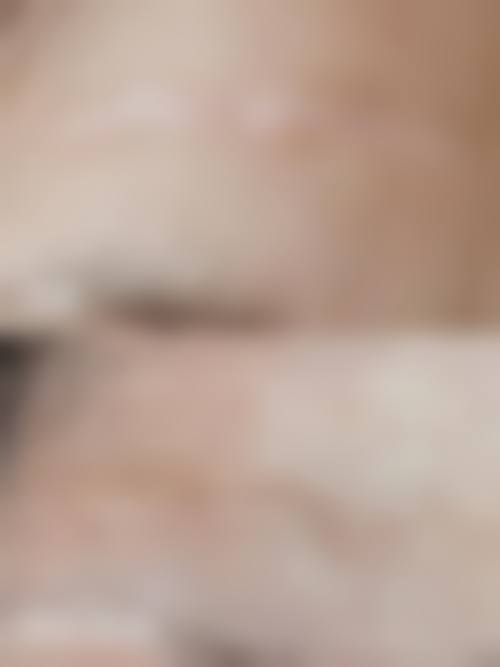 八、西安德莱美医疗美容医院口碑好不好？患者诊室评价：