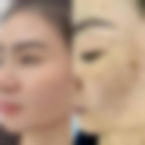 三、黄秀丽医生擅长项目与适合人群