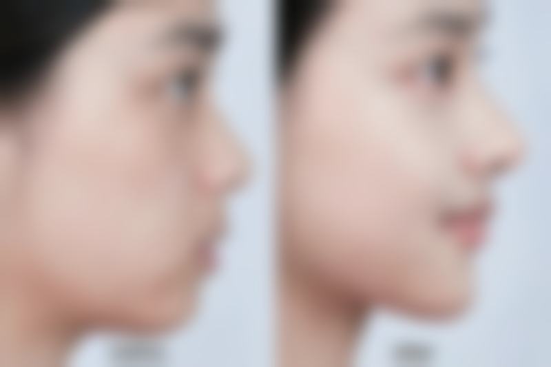 包韩医生擅长项目介绍