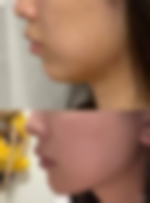 包韩医生的技术与典型操作流程