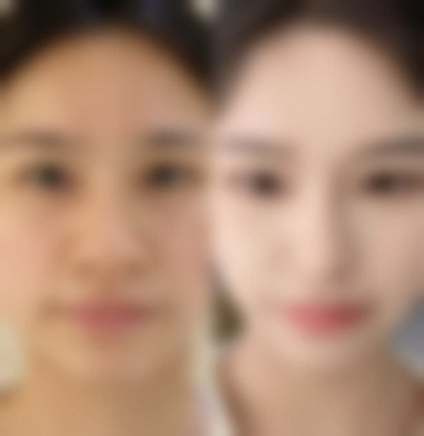 包韩医生患者真实就诊体验 / 口碑实例反馈一例