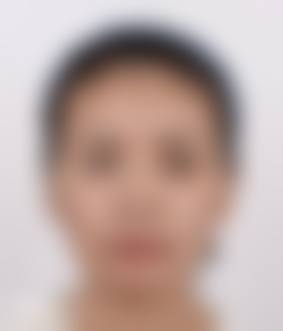 二、陈咏玲医生擅长项目