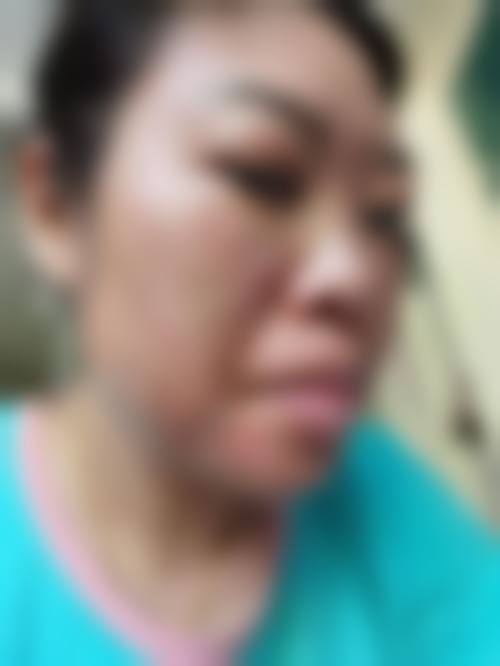 五、陈咏玲医生坐诊哪个医院？