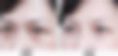 七、郑晓明医生整形项目价格表/收费标准一览(2026年全新)