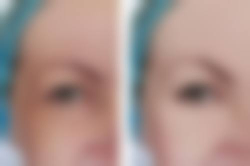 六、郑晓明医生口碑和评价高