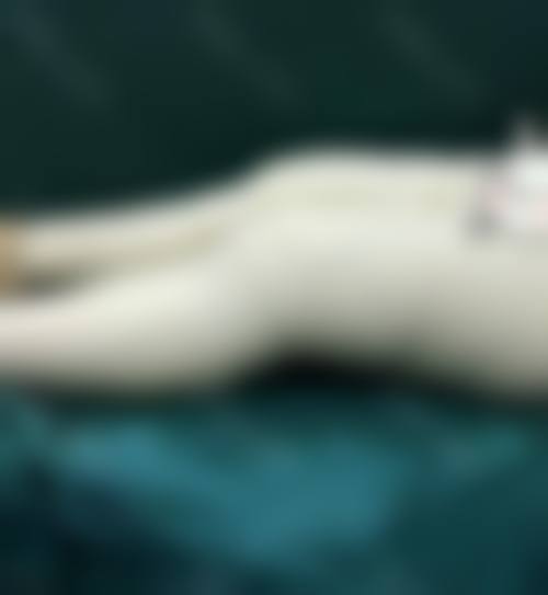 {全身吸脂减肥容易反弹吗？医生揭秘：术后这样做，脂肪细胞不增生，反弹几率低至5%！