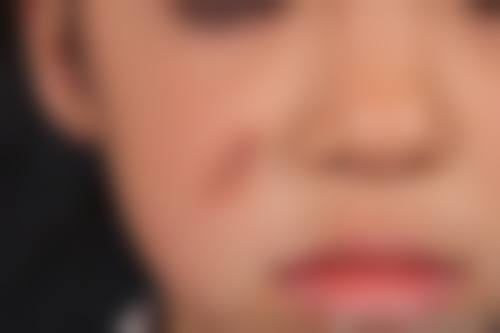 十一、北京东南整形医疗美容医院真人口碑实例评价一览