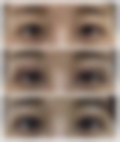 八、杭州越妍整形医院口碑如何