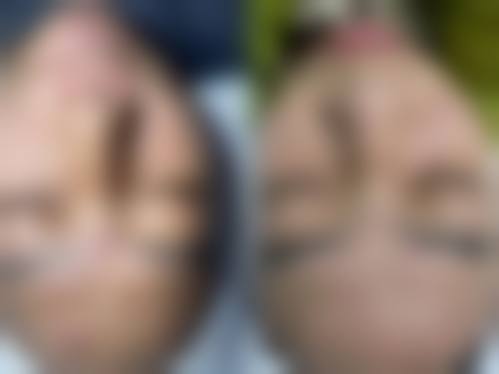 五、李正根医生预约挂号指南