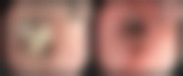 十、杭州越妍整形医院预约挂号指南