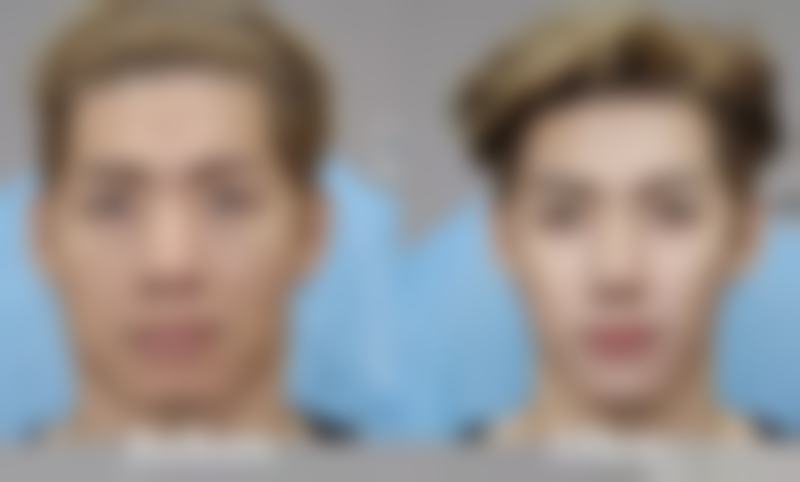 三、李正根医生擅长项目与适合人群