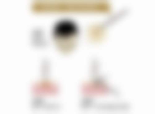 三、李弼伟医生擅长项目与适合人群