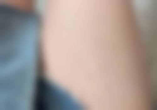 韩国延世sk整形医院口碑如何?来看患者真实评价