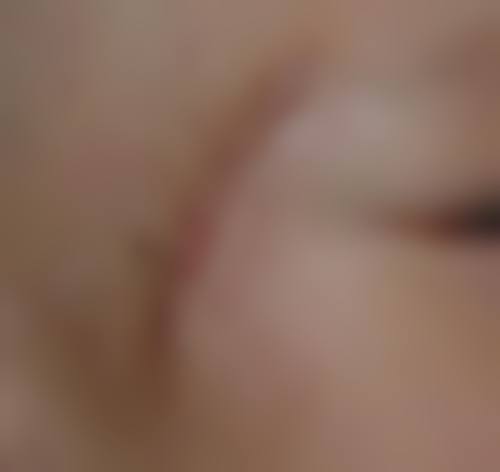 兴义熊文学医疗美容诊所预约挂号