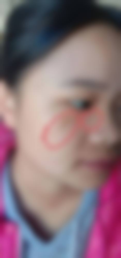 兴义熊文学医疗美容诊所口碑如何